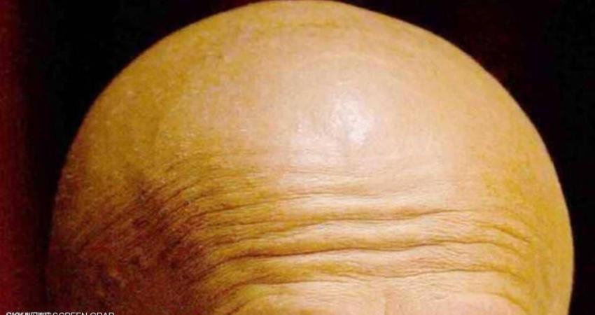 1-1009819