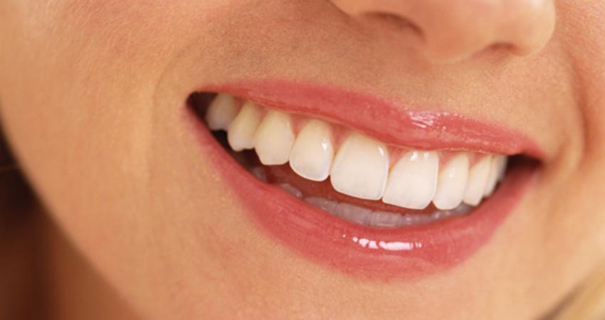 perfect-teeth
