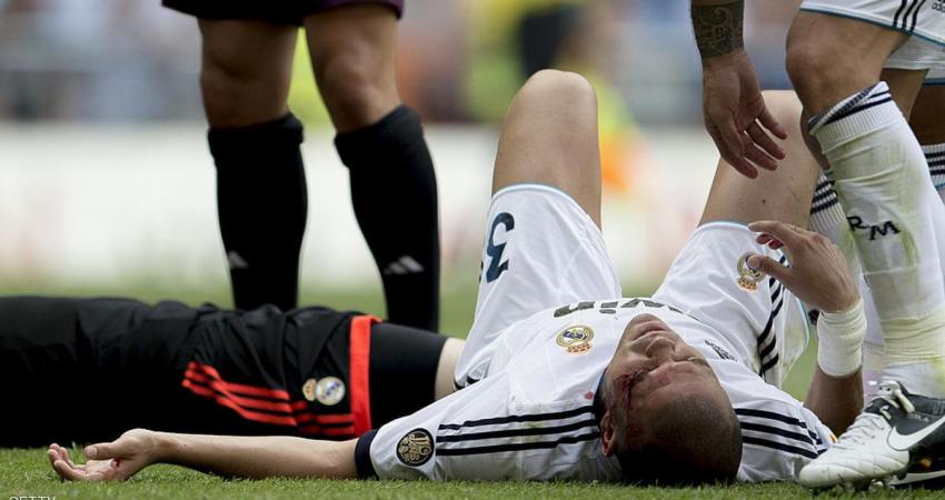 الإصابة تبعد بيبي عن ديربي مدريد والكلاسيكو