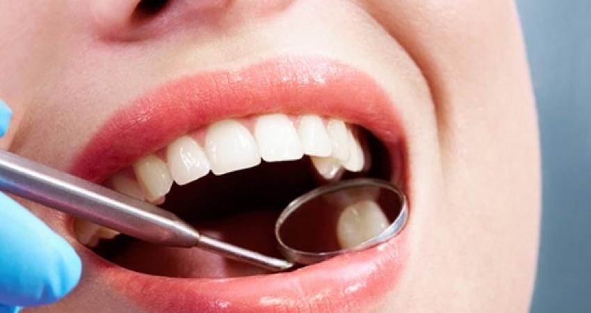 علماء يطورون حشوًا للأسنان تلتئم تلقائيًا