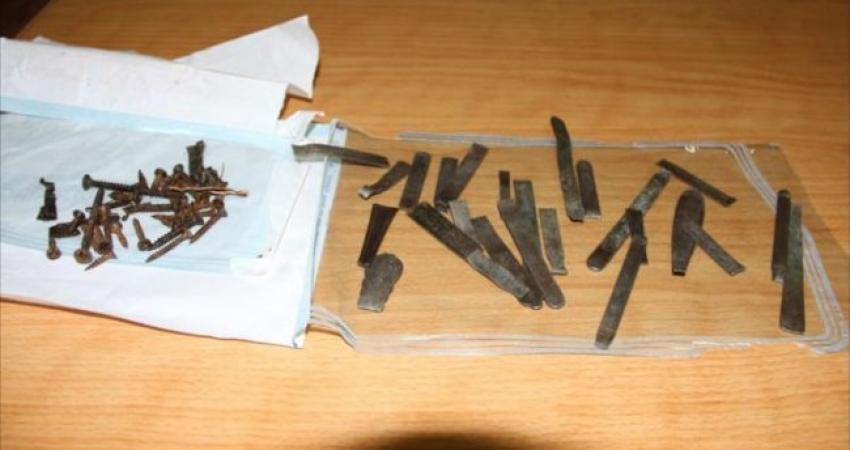 استخراج عشرات الملاعق والبراغي من بطن فلسطيني