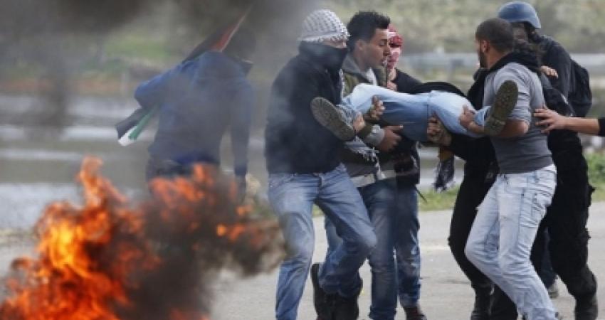 إصابة شابين في مسيرة سلمية ببيت أمر