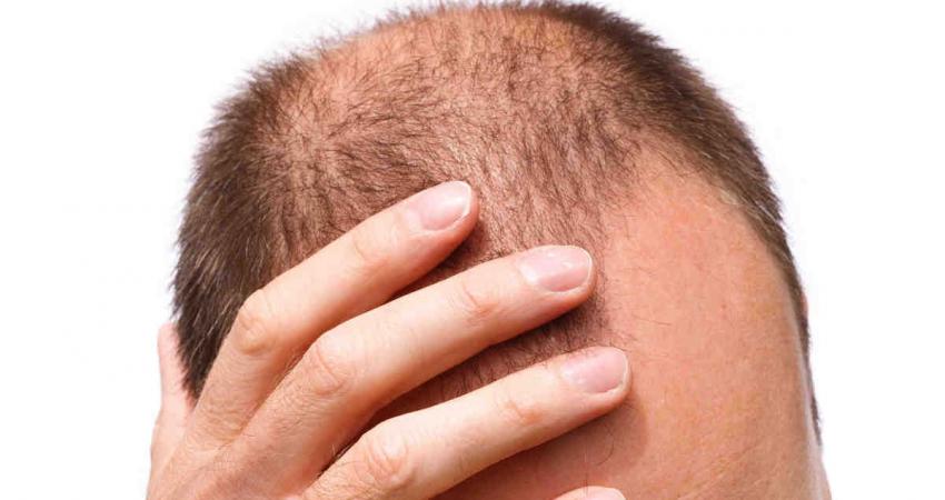الحل الأمثل لعلاج تساقط الشعر والحصول على شعر ناعم تماما