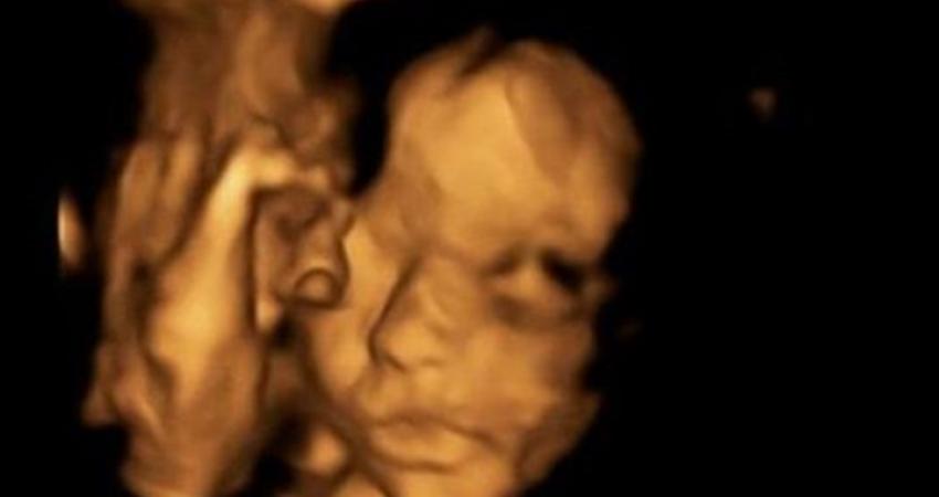 عملية جراحية نادرة ببريطانيا لجنين ثم إعادته إلى الرحم