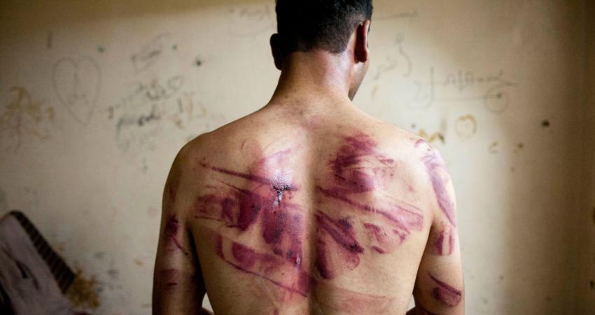 شهادات مروّعة وروايات قاسية عن 