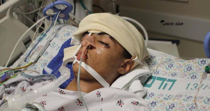 __2__700x370_q85_crop