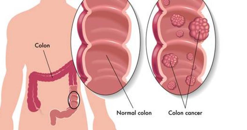 tbl_diseases_disease_24_553