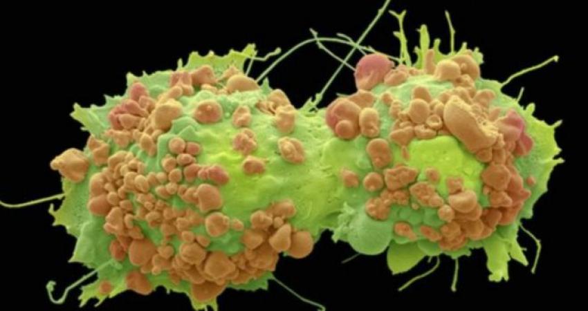 150826111615_cancer_cells_640x360_bbc_nocredit