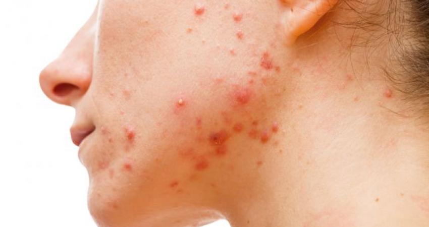 shutterstock_177851702