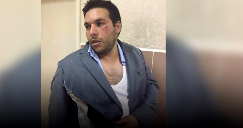 المحامي كراجة جراء الاعتداء عليه