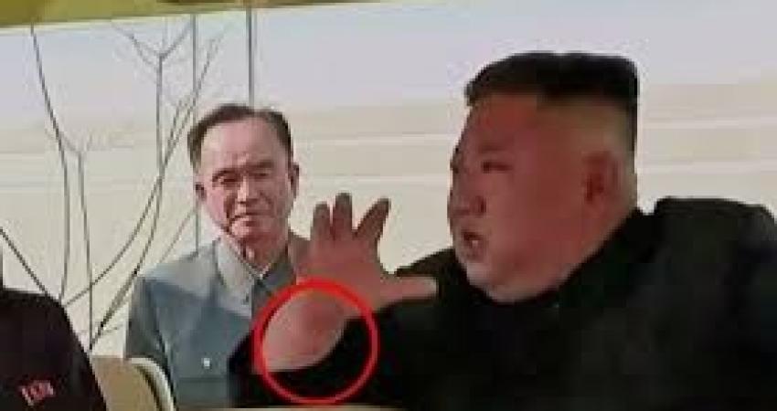 إعلام يرصد "علامة غامضة" على يد كيم جونغ أون