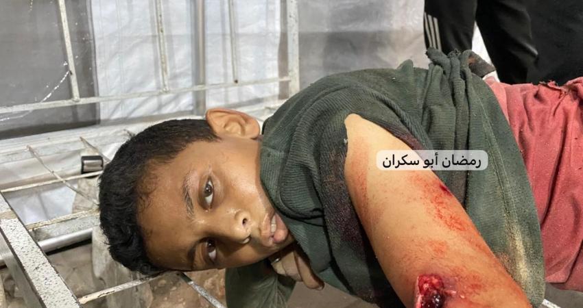 صورة الطفل المصاب