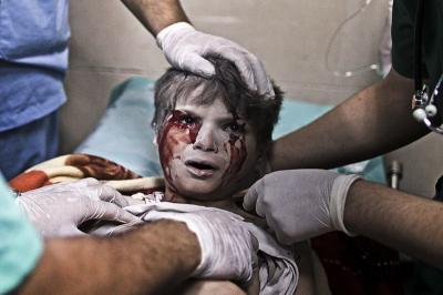 صور: العدوان الإسرائيلي على غزة 2014